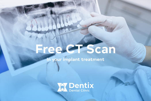 Slider image (2) Dentix